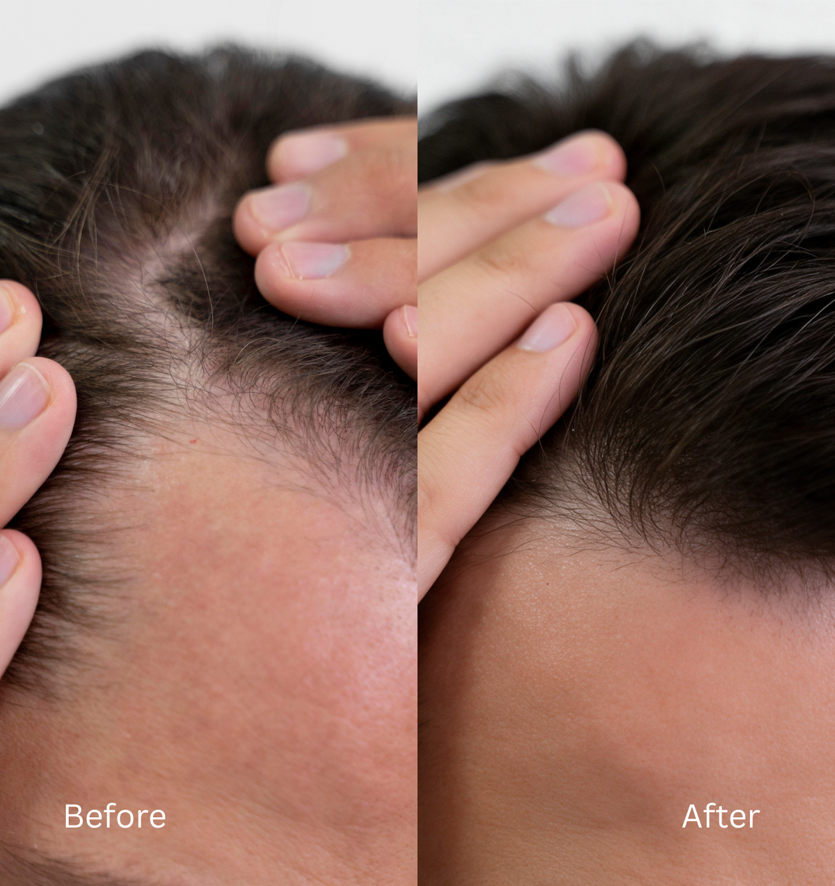 Hair growth results