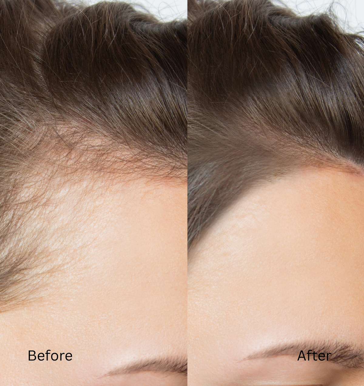 Hair growth results