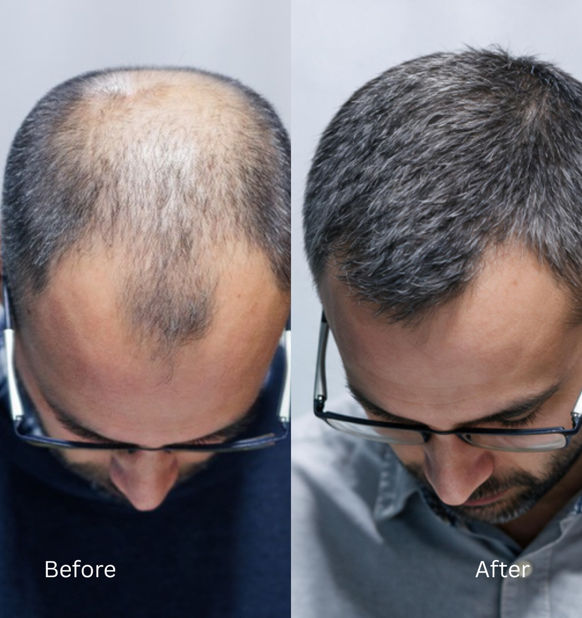 Hair growth results